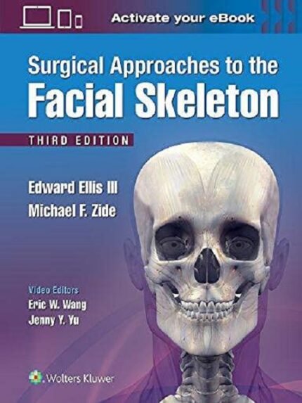 Surgical Approaches To The Facial Skeleton 3rd Ed