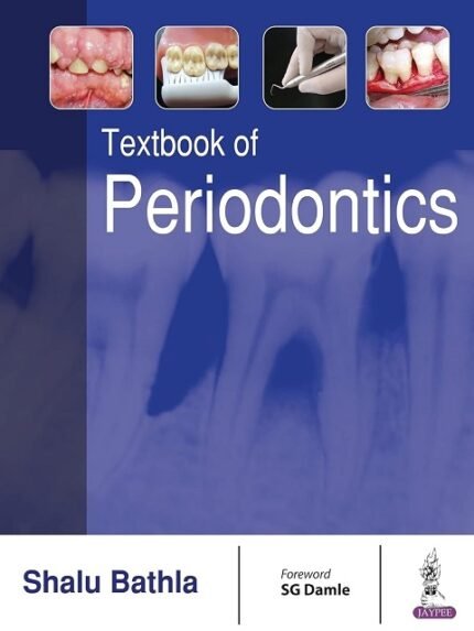 Textbook Of Periodontics 1st Edition
