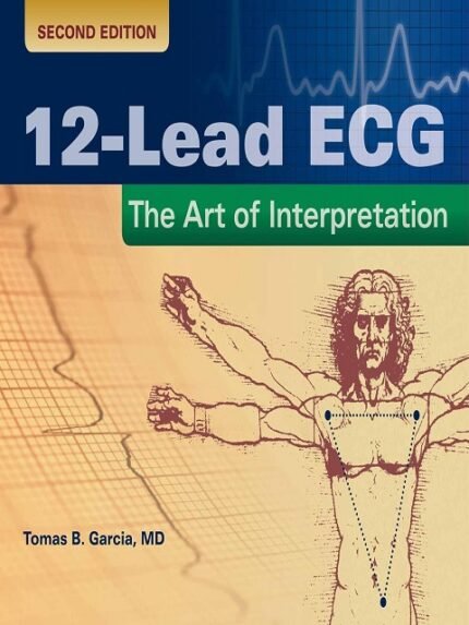 12 Lead ECG The Art of Interpretation The Art of Interpretation 2nd edition