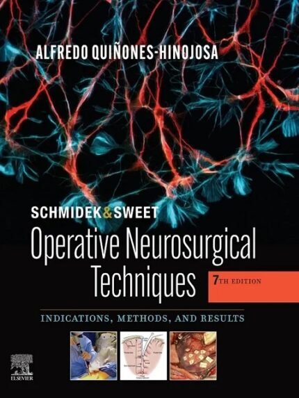 Schmidek and Sweet Operative Neurosurgical Techniques Indications, Methods and Results 7th Edition