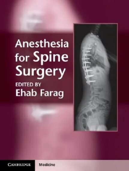 Anesthesia for Spine Surgery 1st edition