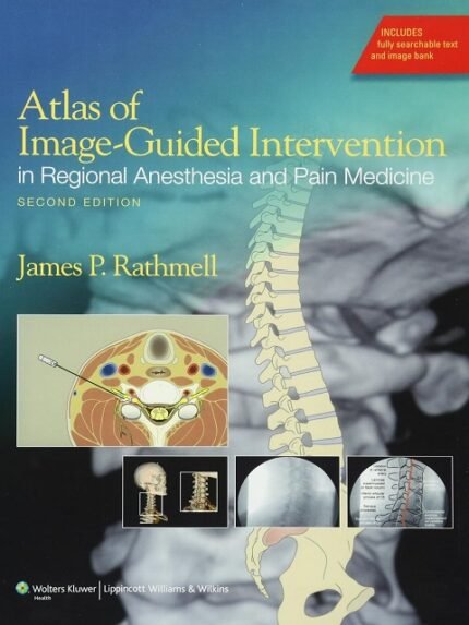 Atlas of Image Guided Intervention in Regional Anesthesia and Pain Medicine 2nd edition