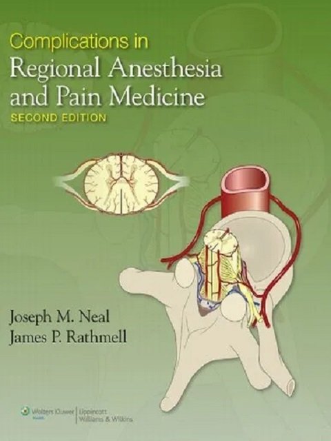 Complications in Regional Anesthesia And Pain Medicine 2nd edition