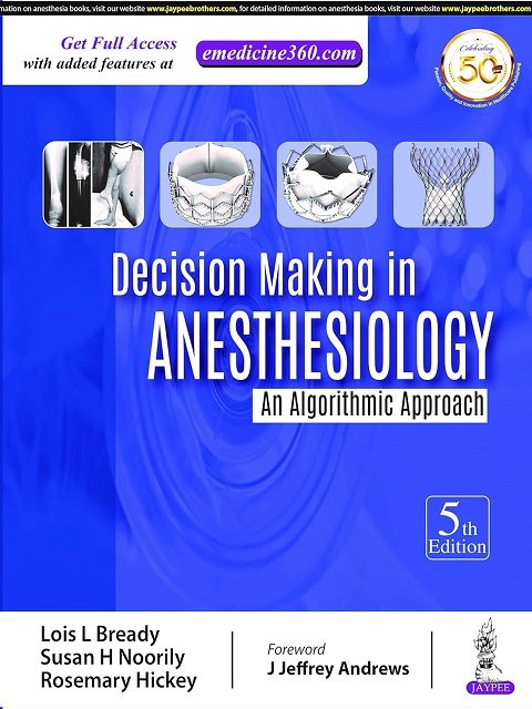 Decision Making in Anesthesiology An Algorithmic Approach