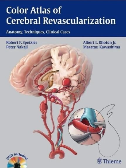 Color Atlas of Cerebral Revascularization Anatomy Techniques Clinical Cases