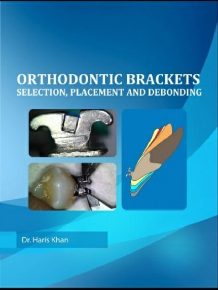 ORTHODONTIC BRACKETS
