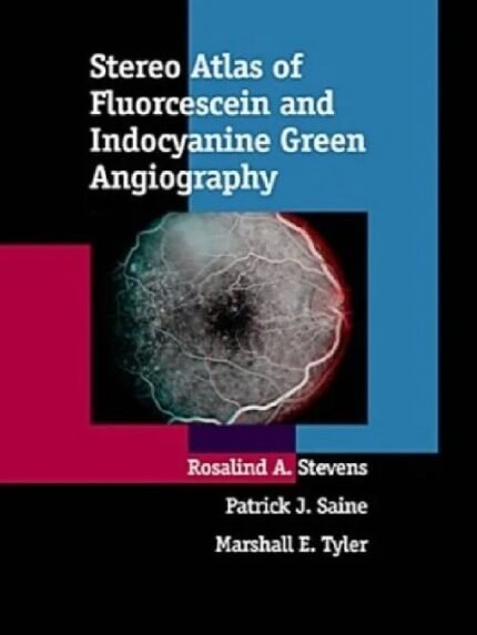 Stereo Atlas of Fluorescein and Indocyanine Green Angiography 1st Edition