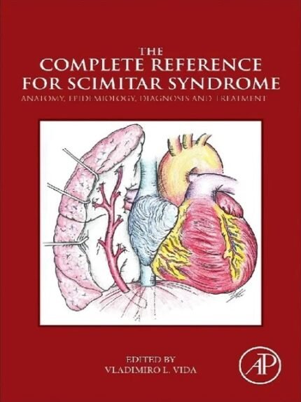 The Complete Reference for Scimitar Syndrome Anatomy, Epidemiology, Diagnosis and Treatment 1st Edition