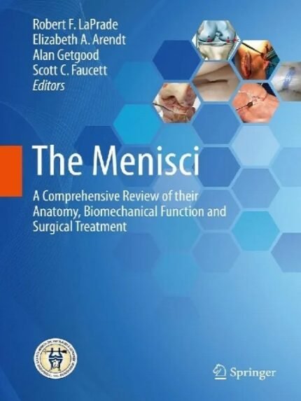 The Menisci A Comprehensive Review of their Anatomy, Biomechanical Function and Surgical Treatment
