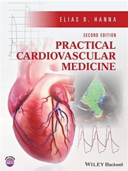 Practical Cardiovascular Medicine 2nd Edition