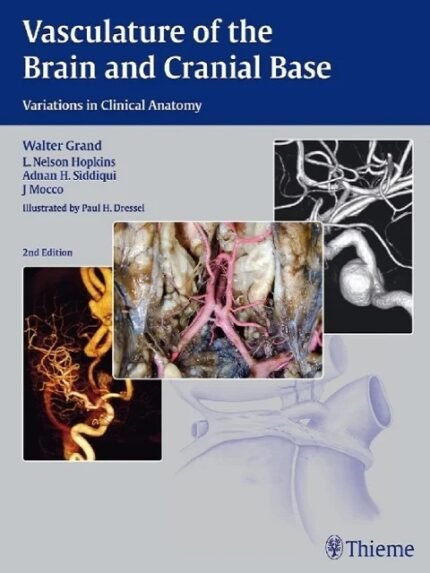 Vasculature of the Brain and Cranial Base 2nd Edition