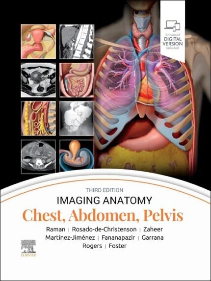 Imaging Anatomy Chest, Abdomen, Pelvis