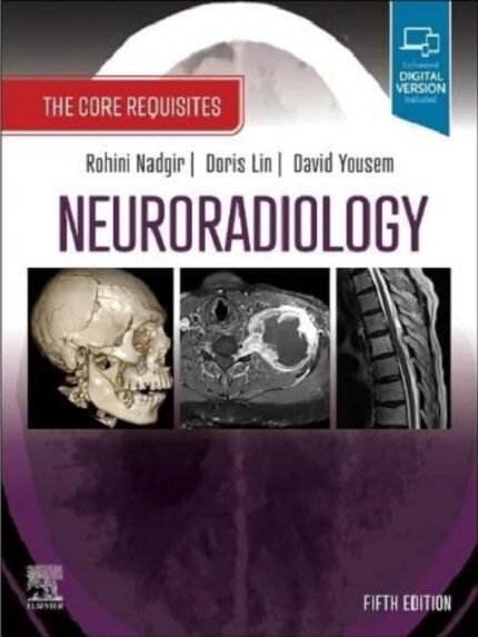 Neuroradiology The Core Requisites