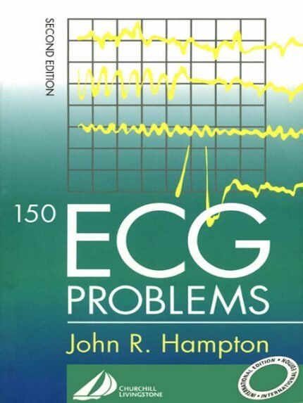 150 ECG Problems 2nd Edition