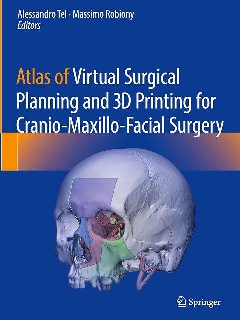 Atlas of Virtual Surgical Planning and 3D Printing for Cranio-Maxillo-Facial Surgery Atlas of Virtual Surgical Planning and 3D Printing for Cranio-Maxillo-Facial Surgery