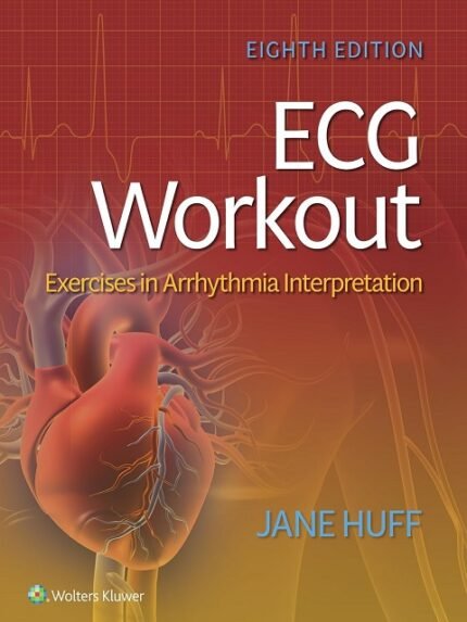 ECG Workout Exercises in Arrhythmia Interpretation