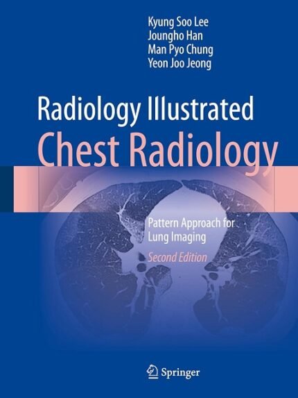 Radiology Illustrated Chest Radiology Pattern Approach for Lung Imaging