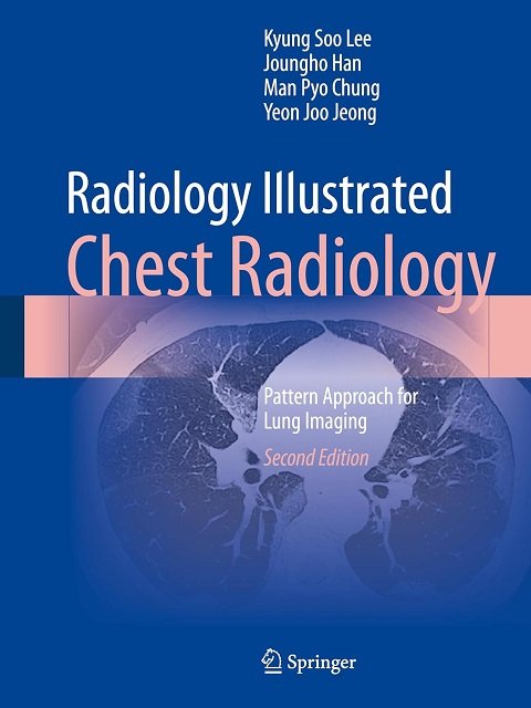 Radiology Illustrated Chest Radiology Pattern Approach for Lung Imaging Radiology Illustrated Chest Radiology Pattern Approach for Lung Imaging