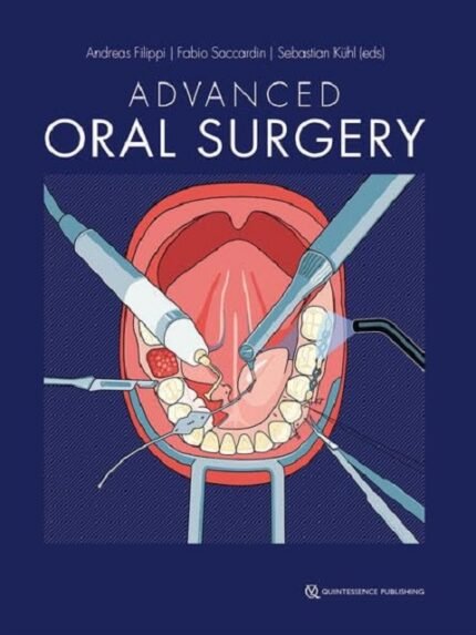 Advanced Oral Surgery'