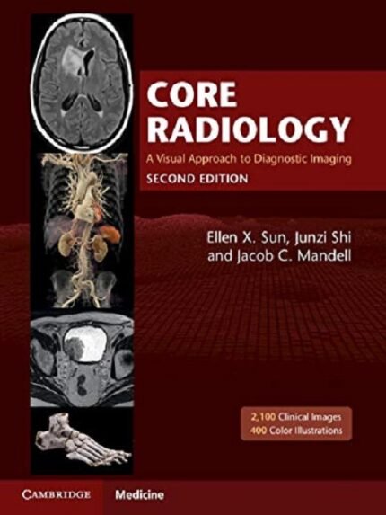 Core Radiology A Visual Approach to Diagnostic Imaging