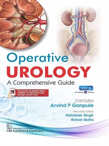 Operative Urology Comprehensive Guide.