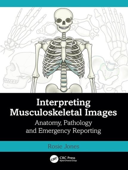 Interpreting Musculoskeletal Images Anatomy, Pathology and Emergency Reporting