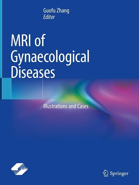 MRI of Gynaecological Diseases Illustrations and Cases MRI of Gynaecological Diseases Illustrations and Cases