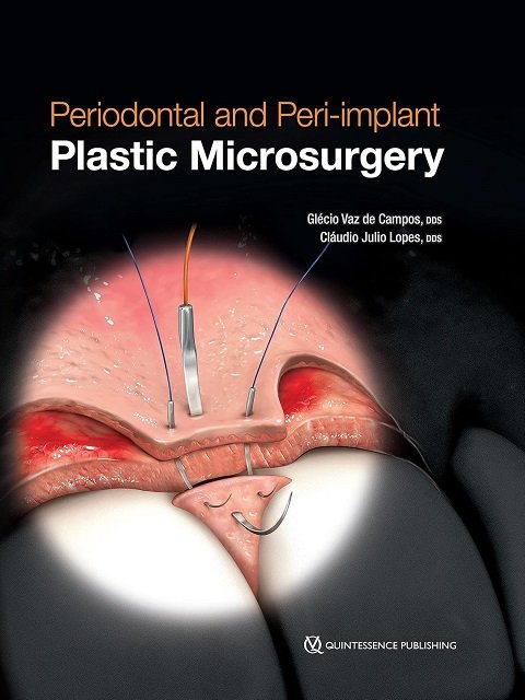 Periodontal and Peri-implant Plastic Microsurgery Minimally Invasive Techniques with Maximum Precision
