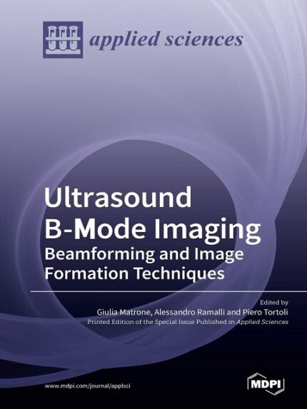 Ultrasound B-Mode Imaging Beamforming and Image Formation Techniques